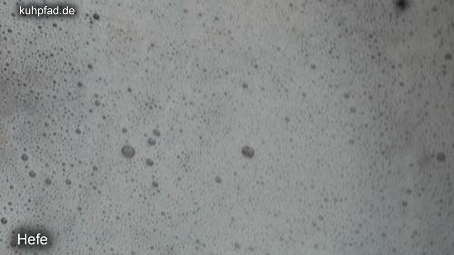 Bierhefe Bierhefe
